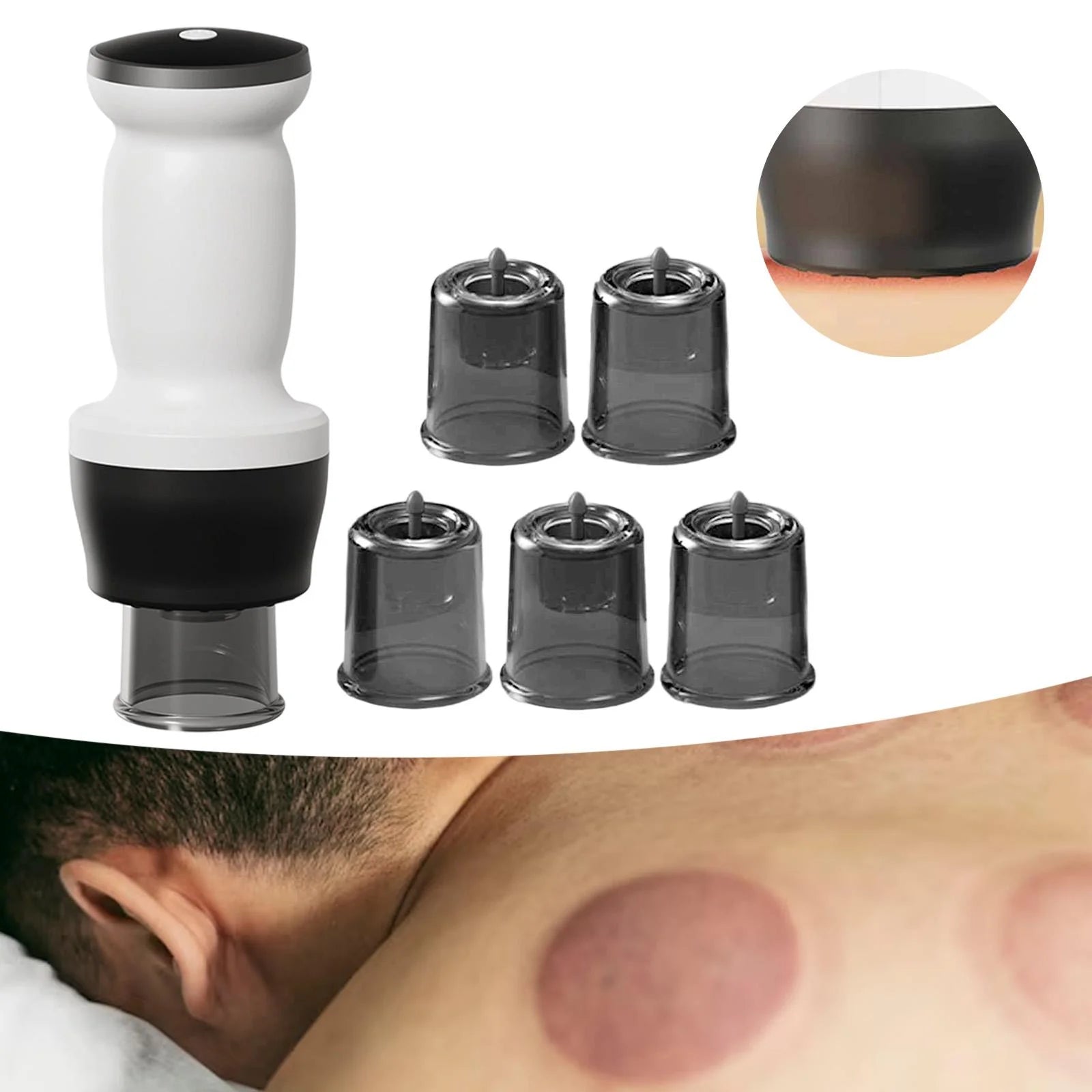 Intelligent Negative Pressure Cupping Massage Instrument